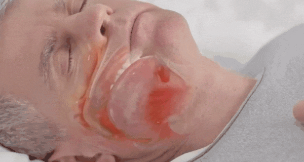 SnarkStop™ | Fri andning, fri sömn 1 + 1