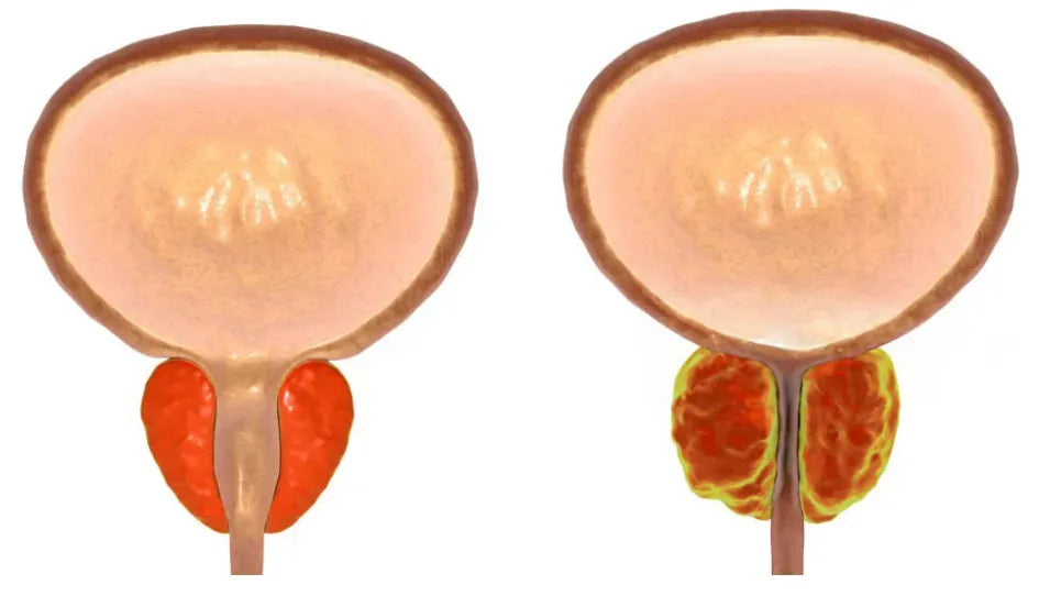 TorrTrygghet™ - Naturligt Plåster för Blåskontroll och Självsäkerhet