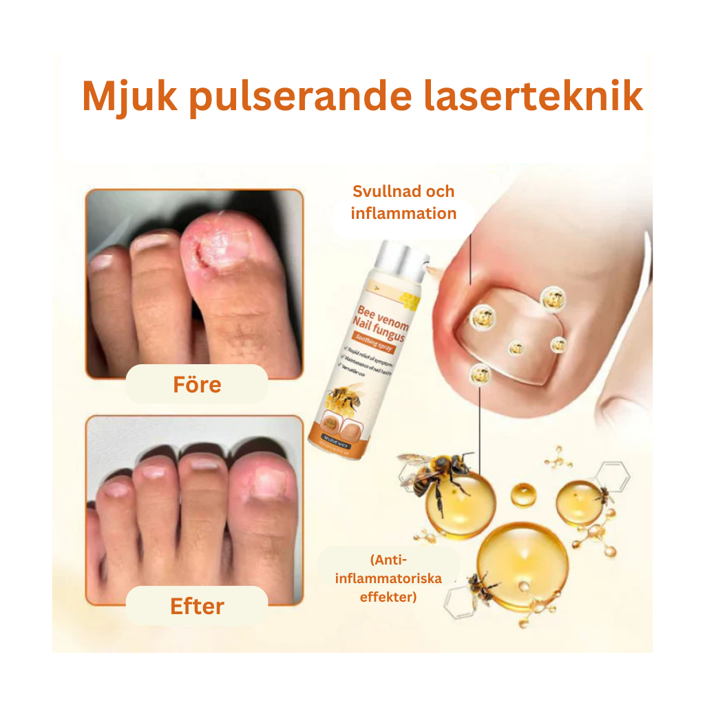 PropoFix™ - Avancerad svampbekämpande nagelspray