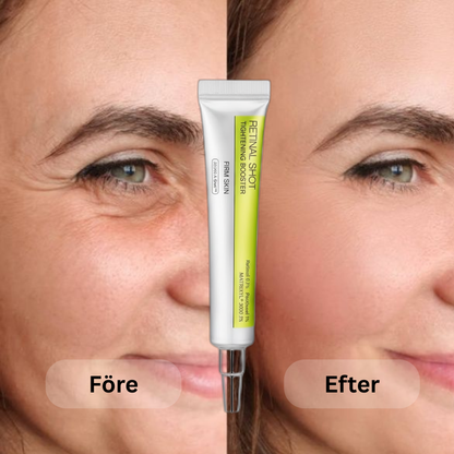 CalmiLift™ – Slätar ut fina linjer & ger nytt liv åt trötta ögon