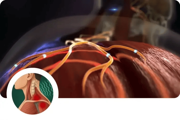 NackLindra™ - 11-i-1-lösning för nackbesvär | Slappna av i nackmusklerna på bara 15 minuter – var och när du vill