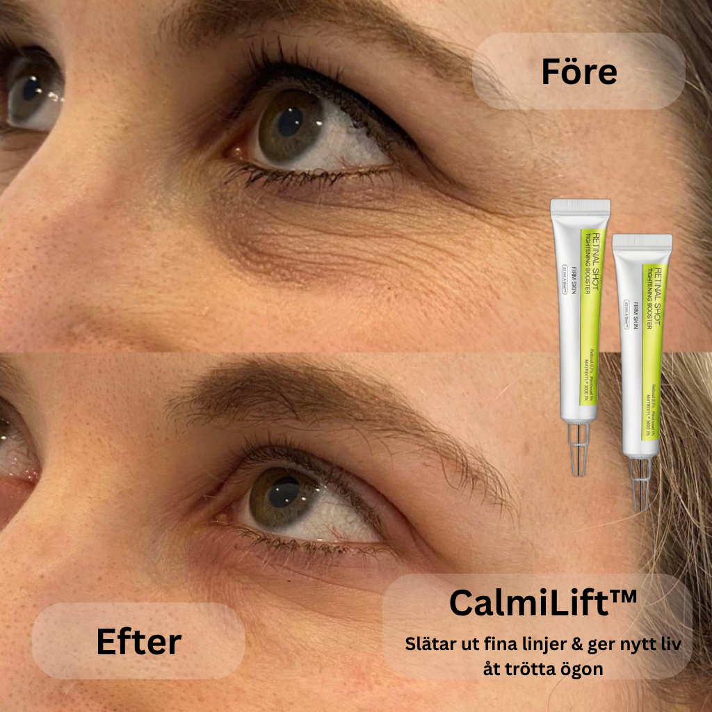 CalmiLift™ – Slätar ut fina linjer & ger nytt liv åt trötta ögon