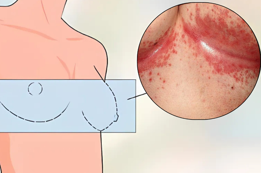 DermaVeck™ – Smärtfria hudveck igen – skydda och lugna irriterad hud