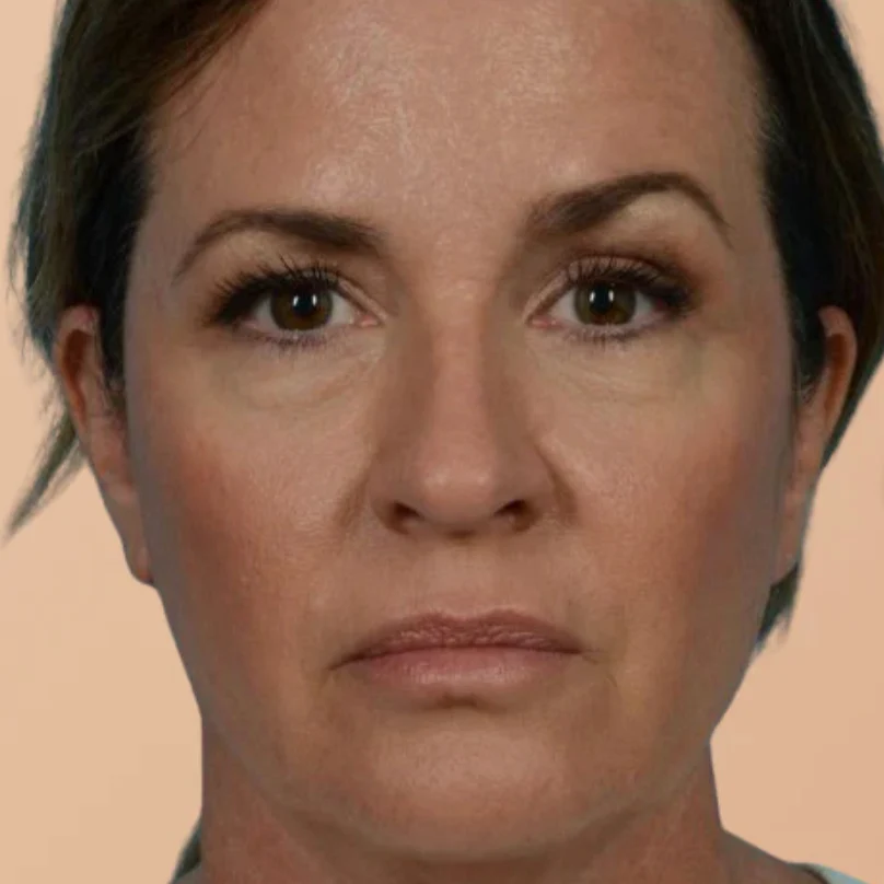 LymfBrush™ - Skonsam stimulans för ett friskare lymfsystem