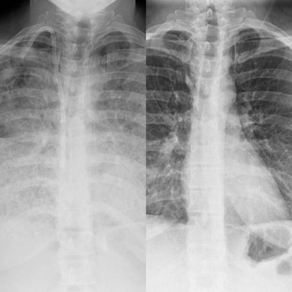 Lunavia™ – Naturlig Luftvägsstöd för Frisk och Lätt Andning