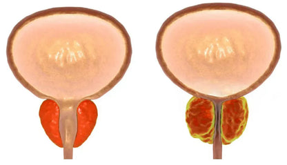 TorrTrygghet™ - Naturligt Plåster för Blåskontroll och Självsäkerhet